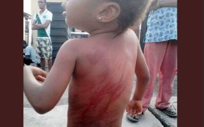 4-year-old girl gets brutally flogged for the flimsiest reason