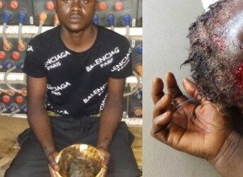 Graphic photos: Yahoo Boy attempts to kill his mother for money rituals in Lagos