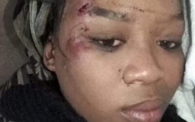 ‘How my husband of over 10 years ran over me with his car’ – South African woman shares disturbing story