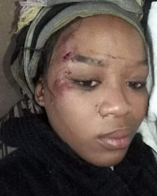 ‘How my husband of over 10 years ran over me with his car’ – South African woman shares disturbing story