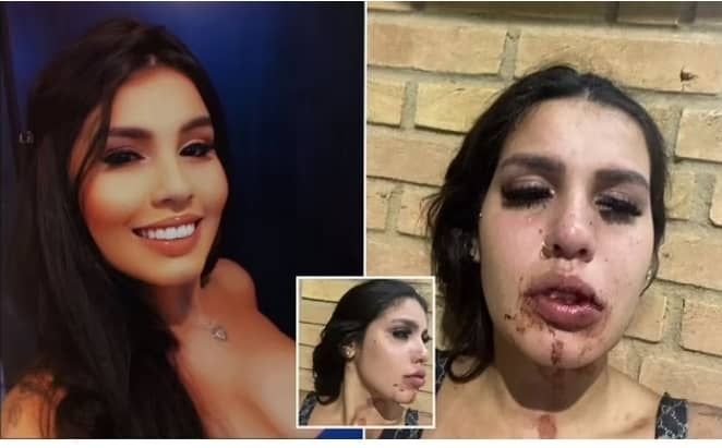 Instagram Star Is ‘Drugged, Gang-raped And Beaten